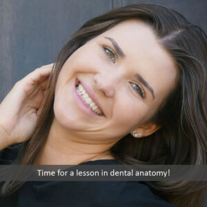 Woman smiling showing her dental anatomy